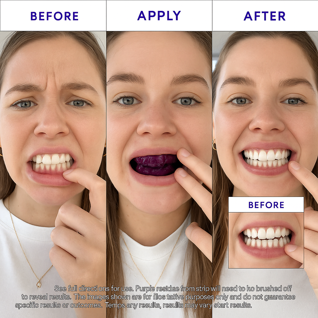 PurpleSmile™ Teeth Whitening Strips