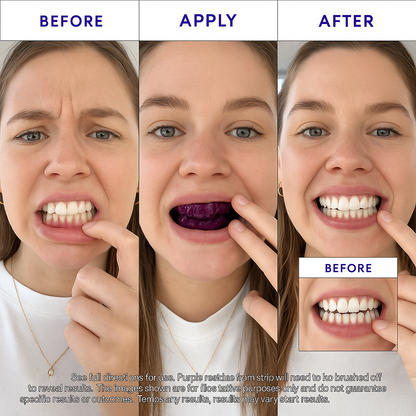 PurpleSmile™ Teeth Whitening Strips