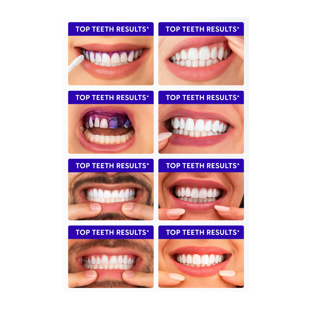 PurpleSmile™ Teeth Whitening Strips